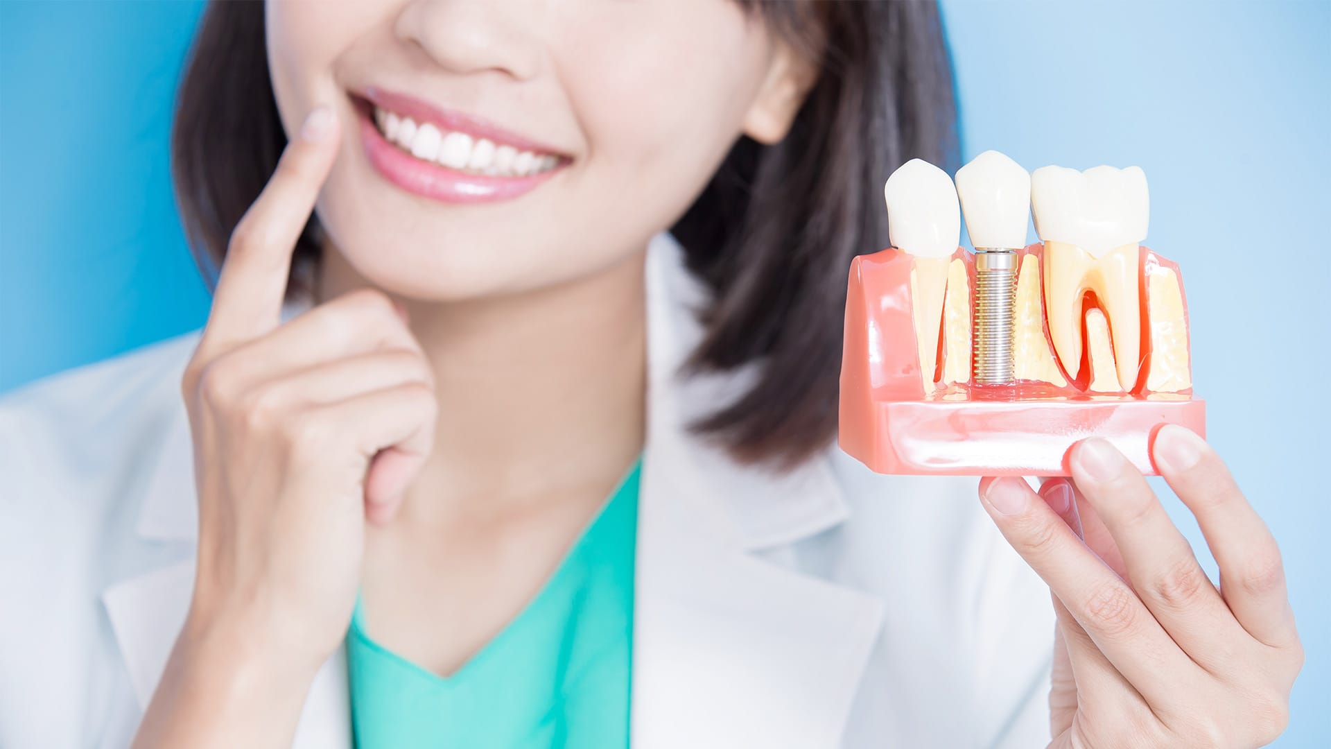 Implant Articles - image 31