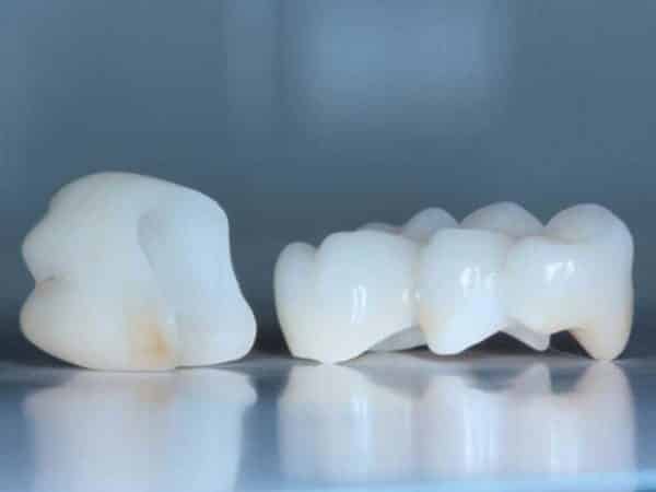 Prosthetics - image 10