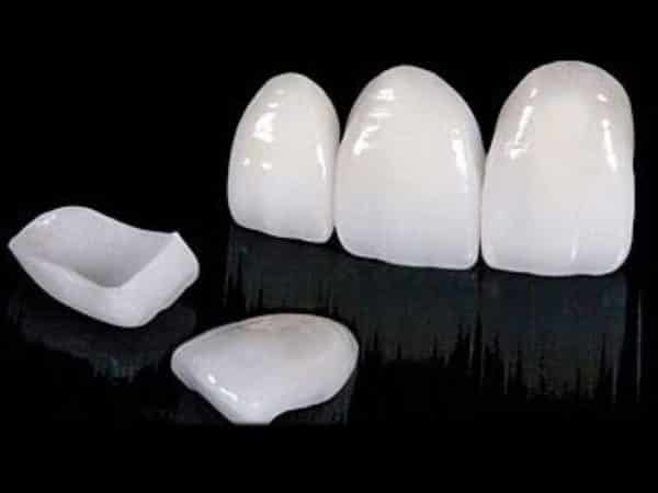 Prosthetics - image 7