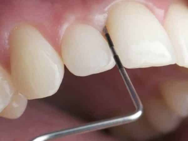 Periodontology - image 7
