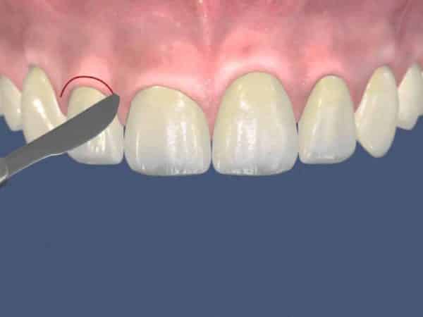 Surgery - image 8