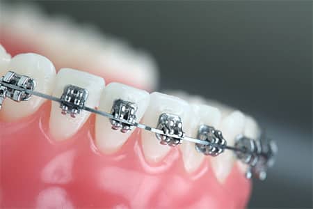 bracket systems - image 7
