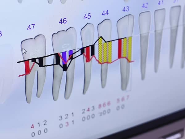 Periodontology - image 8