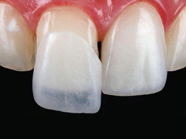 Prosthetics - image 8