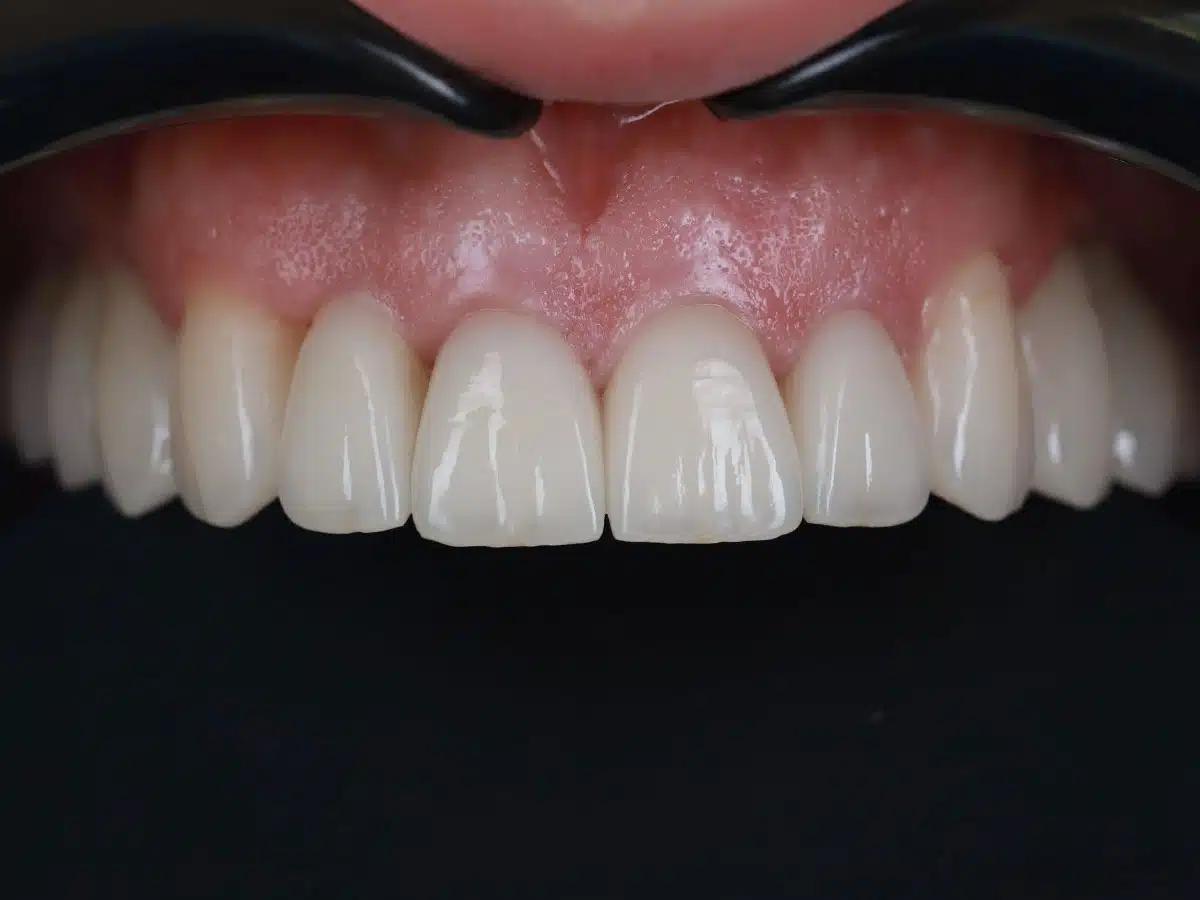 The story of one total restoration - image 8