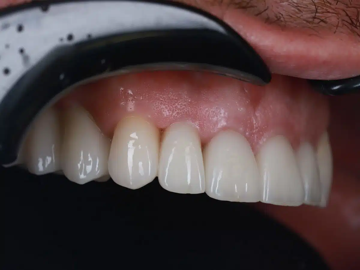 The story of one total restoration - image 11