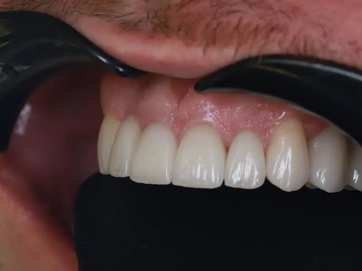 The story of one total restoration - image 12