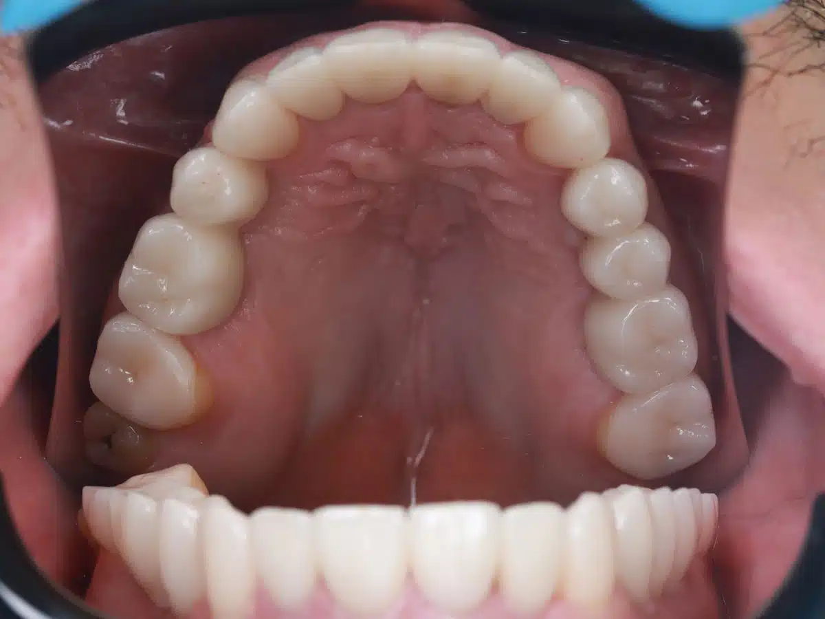 The story of one total restoration - image 13