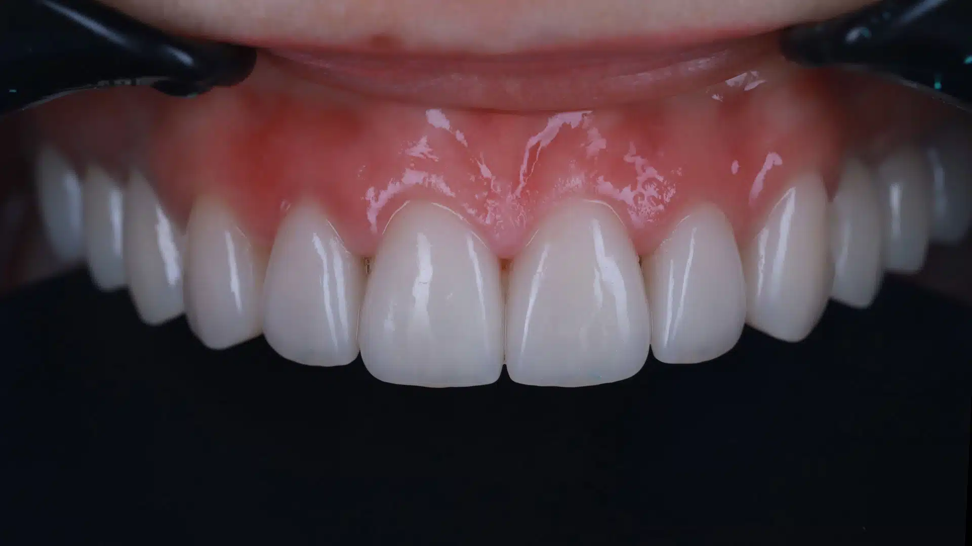 Case3Title Услуги Клиники - image 38