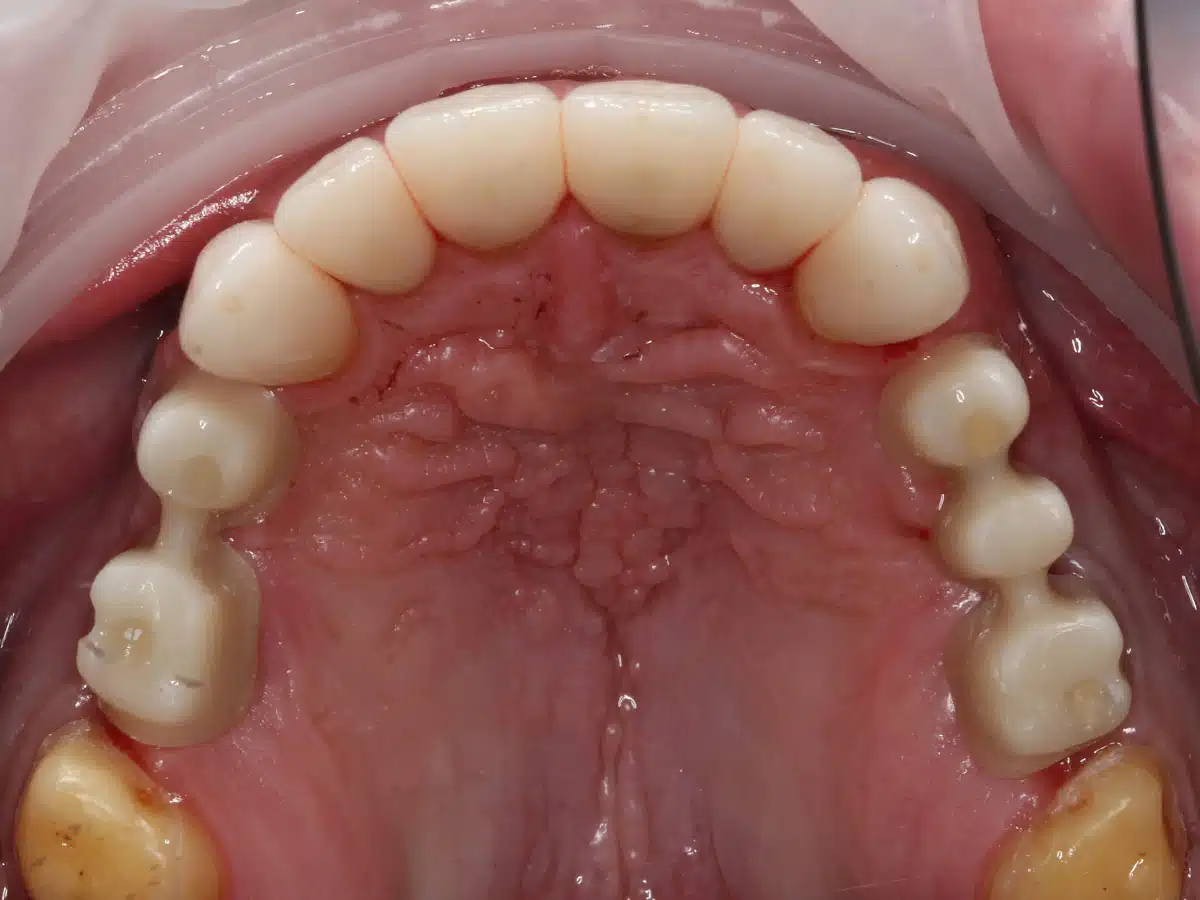 The story of one total restoration - image 7