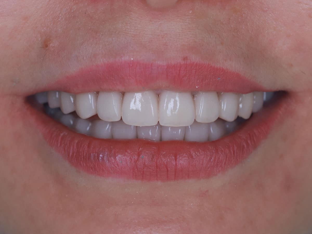 You live in Europe? Treat your teeth in Ukraine! - image 15
