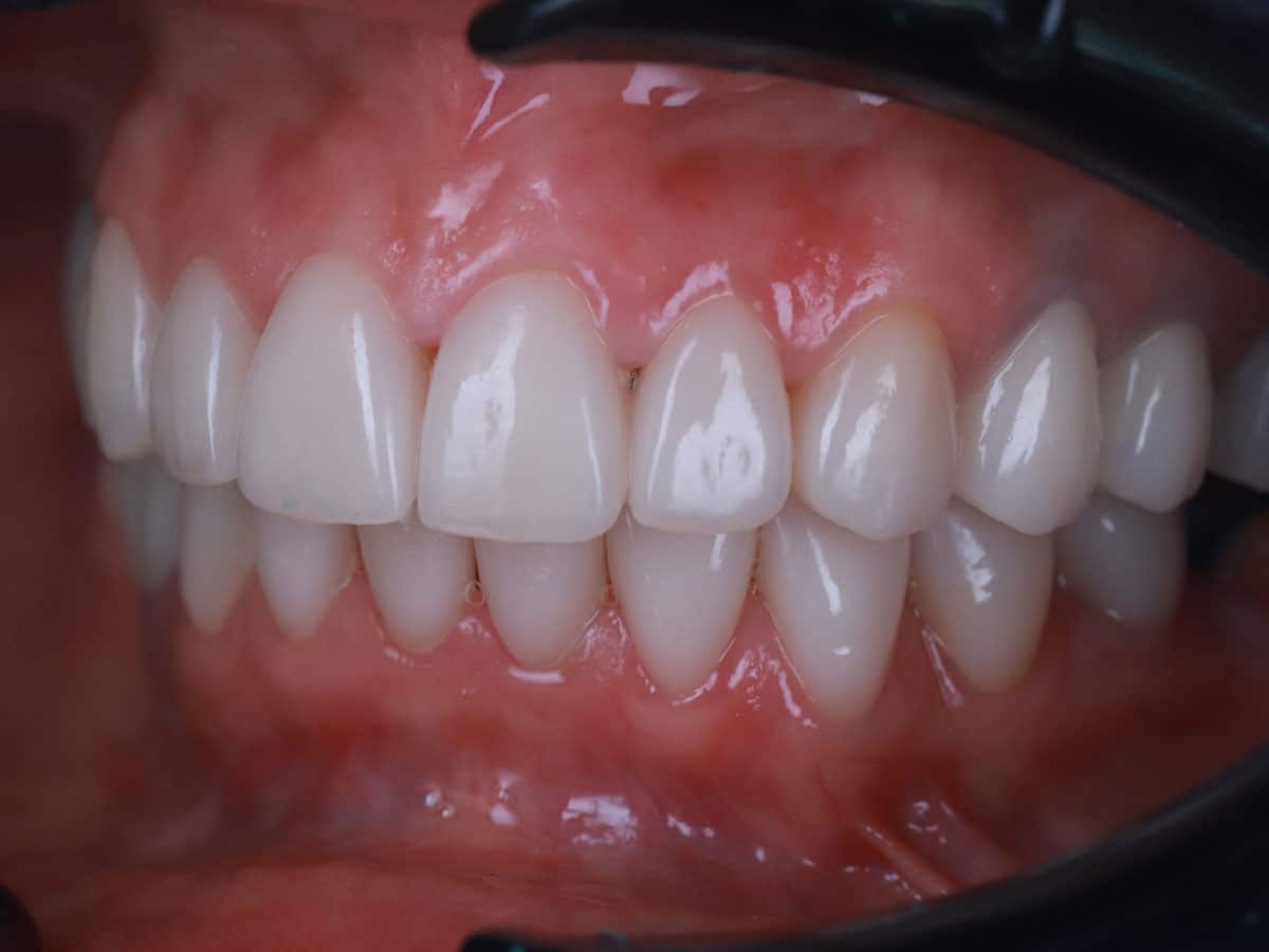 From cleaning to total restoration - image 8
