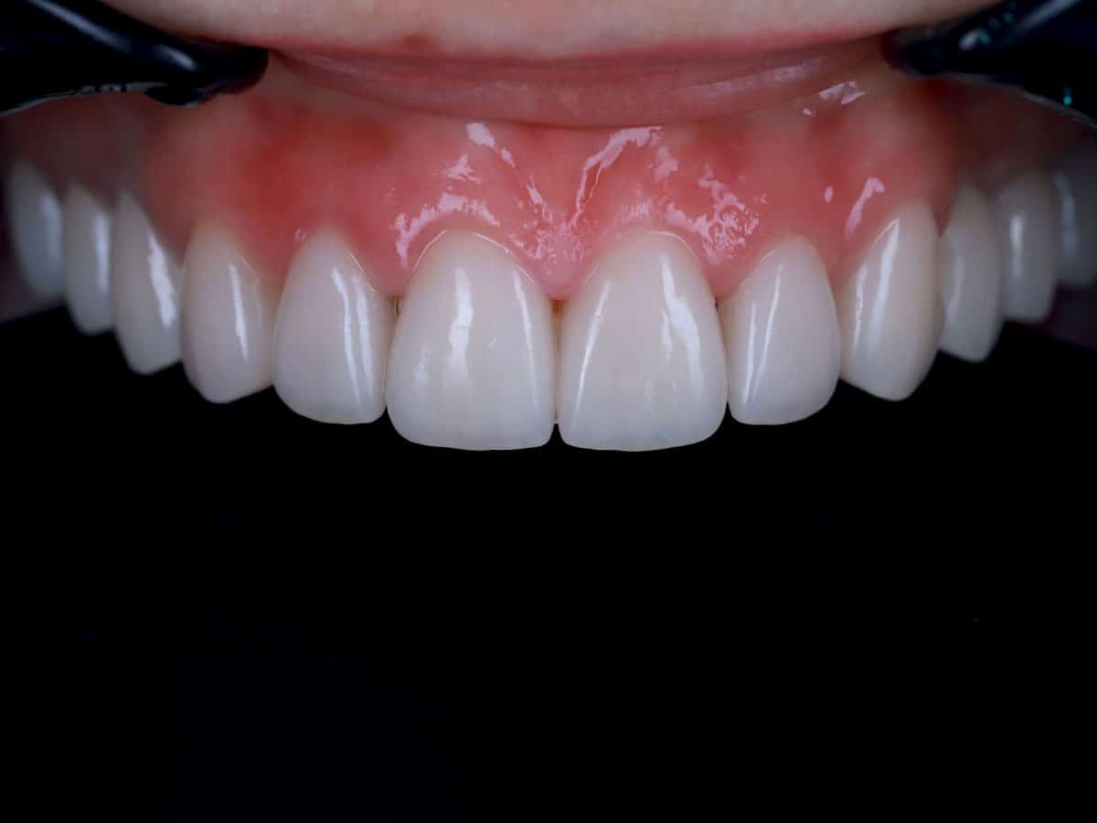 You live in Europe? Treat your teeth in Ukraine! - image 13