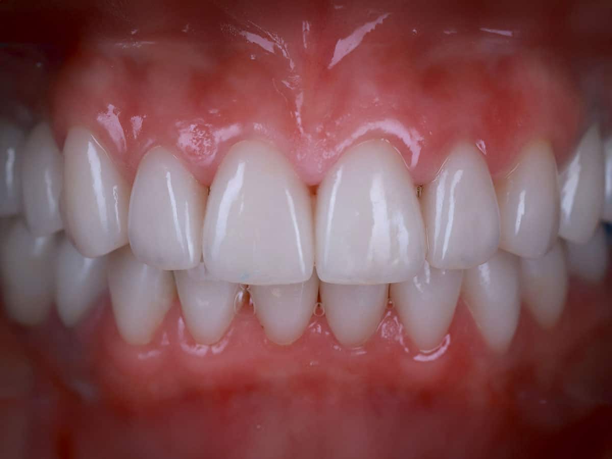 You live in Europe? Treat your teeth in Ukraine! - image 16