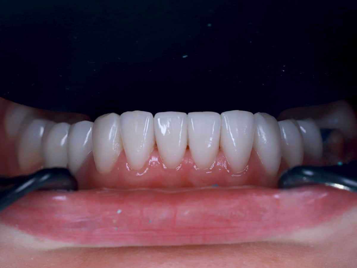 From cleaning to total restoration - image 11