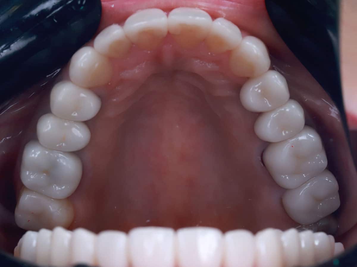 From cleaning to total restoration - image 12