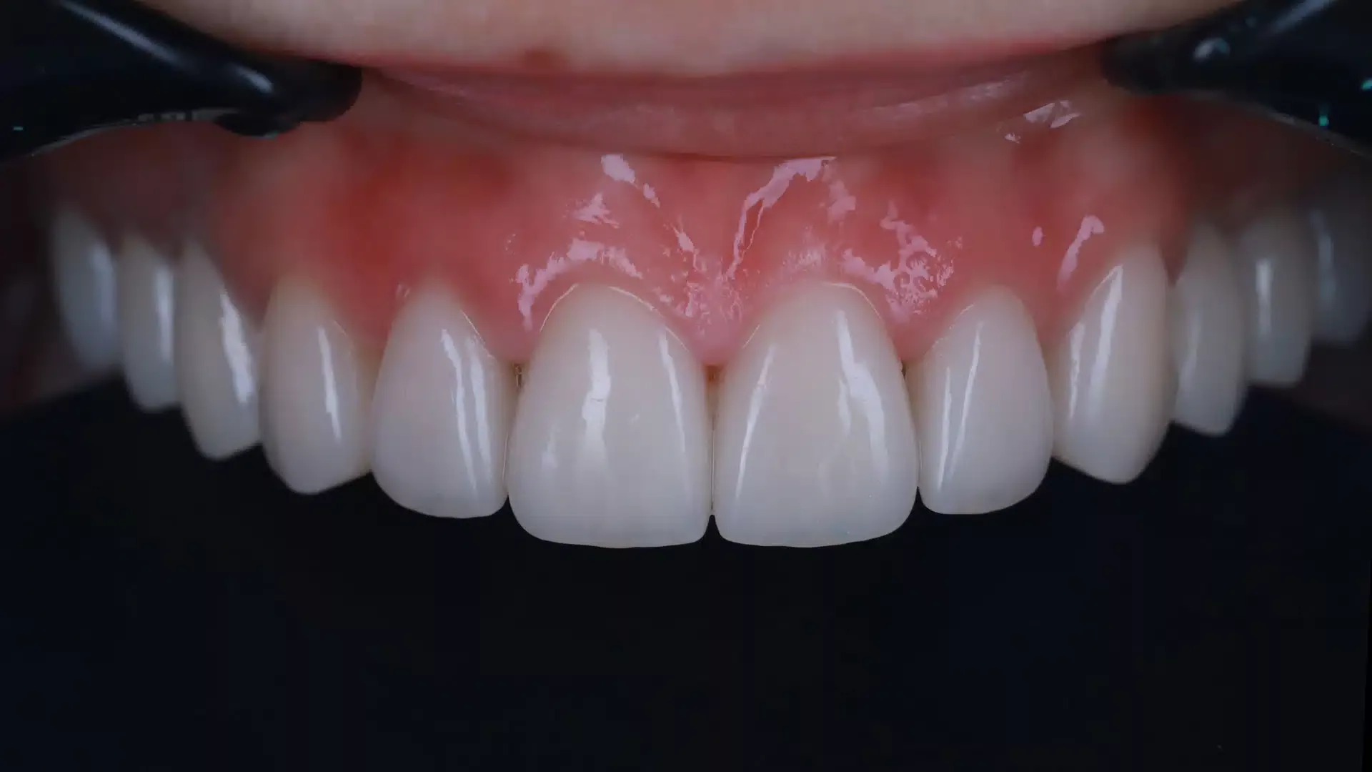 Case3Title Услуги Клиники - image 38