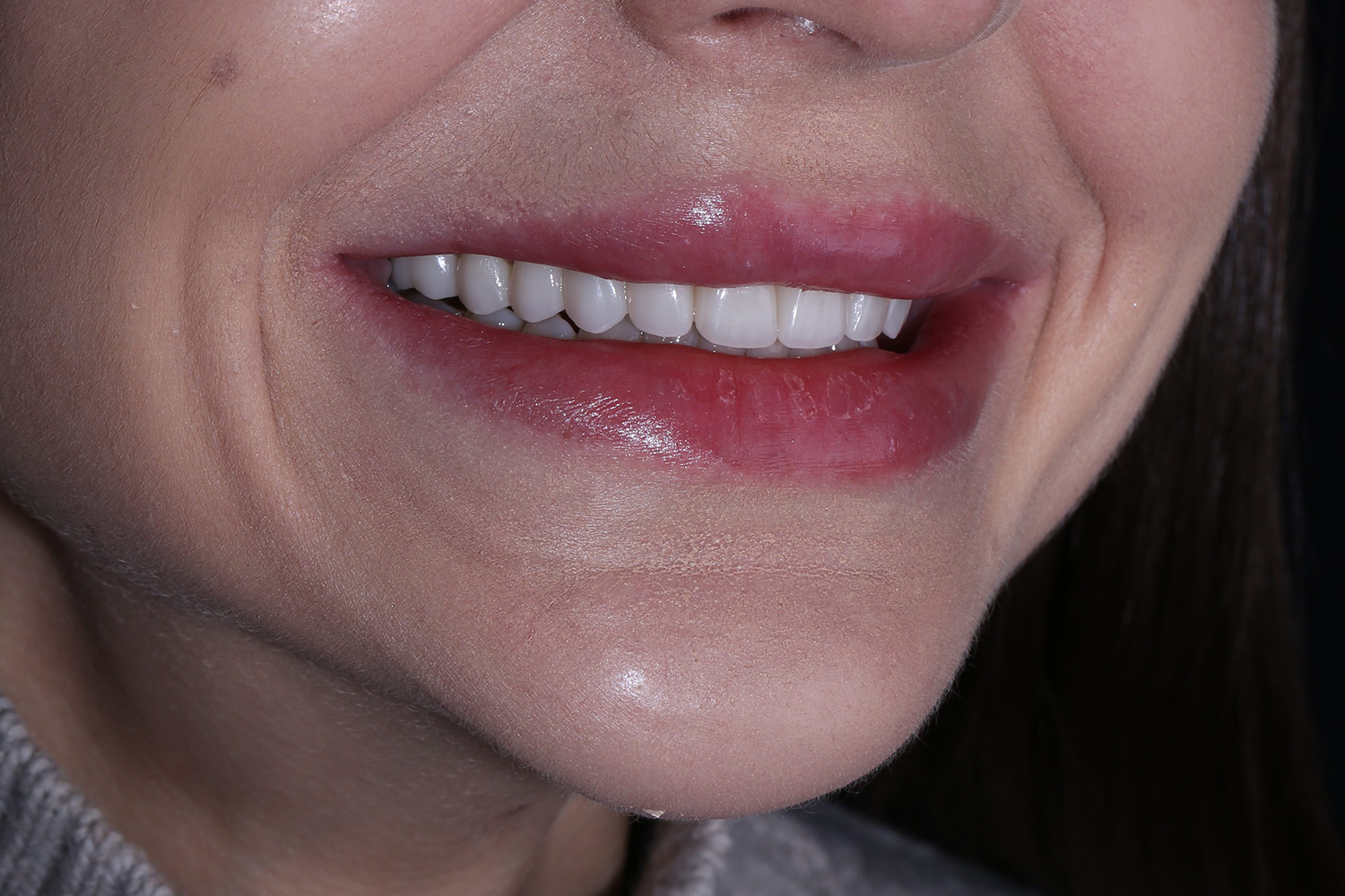 Case2-gal1 Case No. 2 - image 7