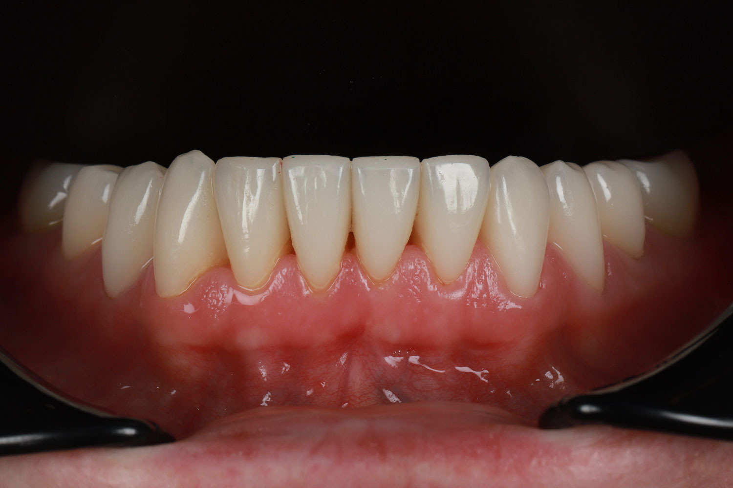 Case No. 1 - image 10
