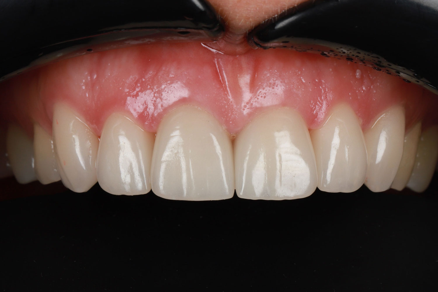 Case3-gal5 Case No. 3 - image 11