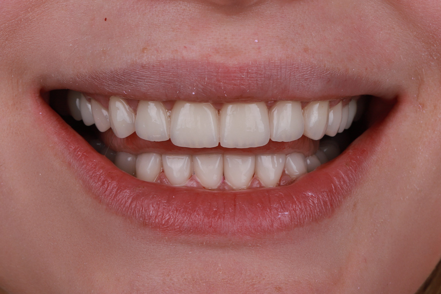 Case No. 4 - image 9