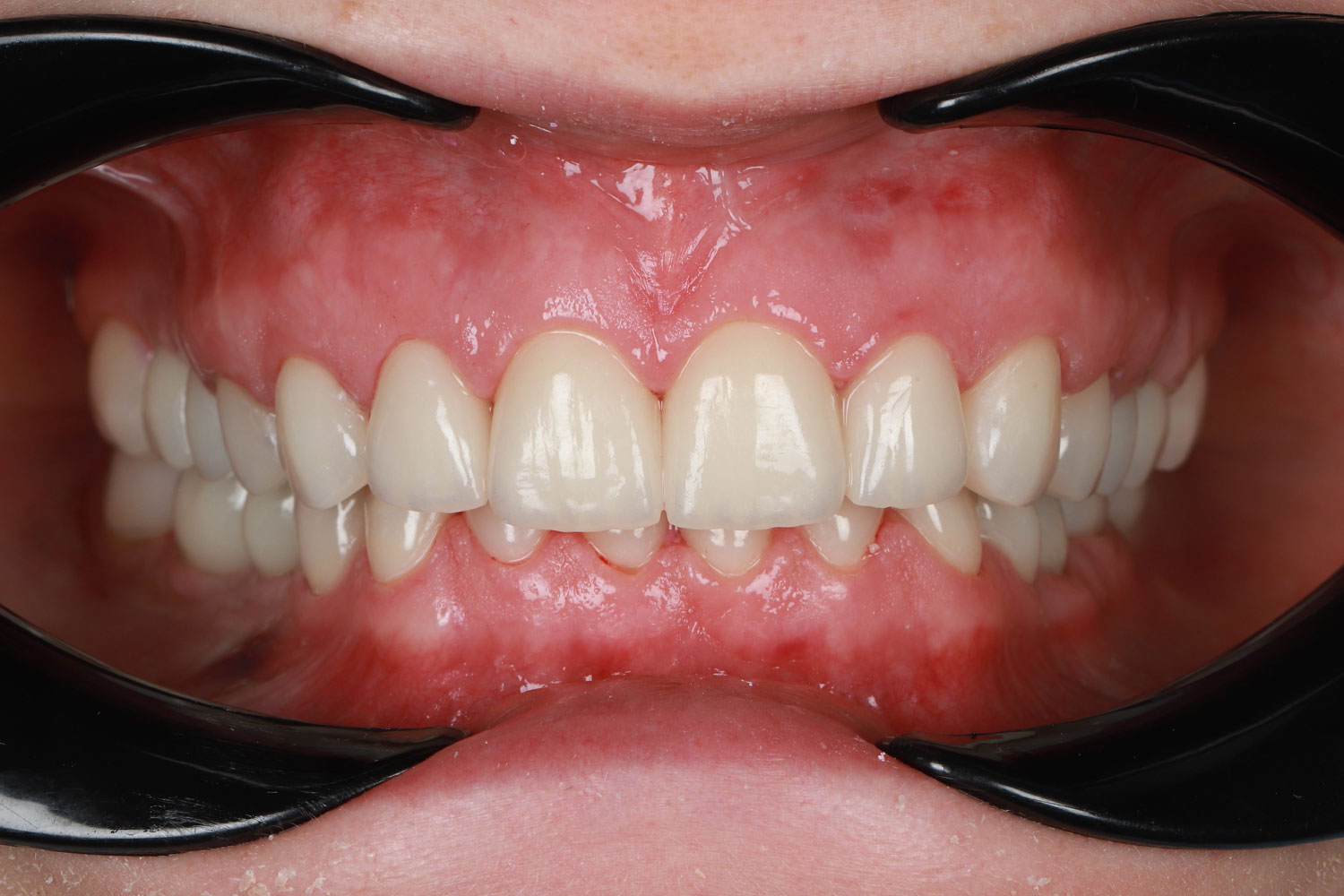 Case No. 4 - image 10
