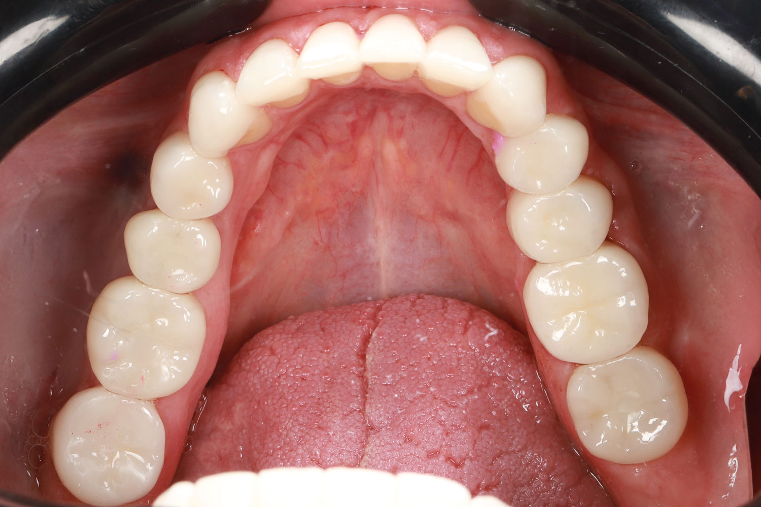 Case No. 4 - image 12