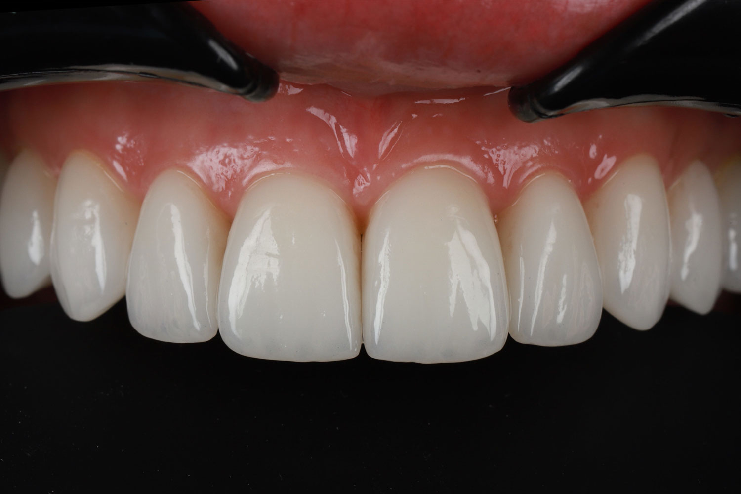 Case No. 5 - image 11